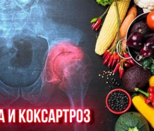 Диета для похудения при коксартрозе
